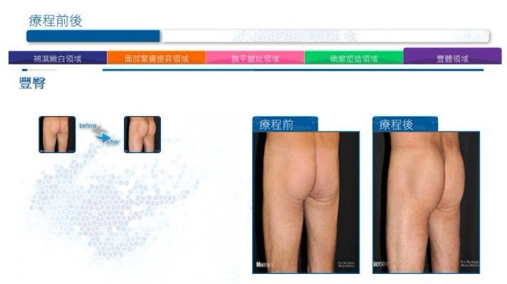 ͸��������