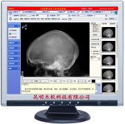 X��Ӱ��ϵͳ����վ