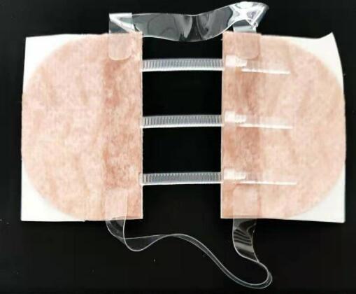 ҽ�ÿɵ�ʽ����Ƥ�������