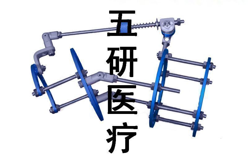 Ilizarov��̶���--��ؽڹ���