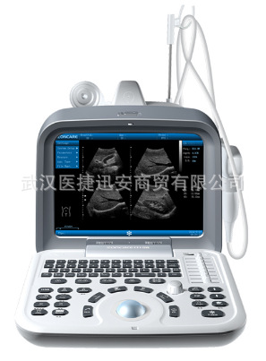 ����ZQ-6600ȫ���ֳ������ϵͳ ��ЯB�� �ڰ�B�� �����ճ�����