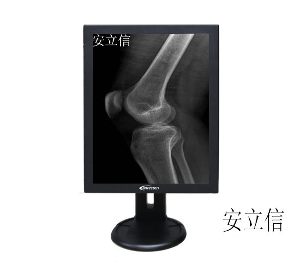 ������DR���ϵͳ/���Ͷ���CT/MRI�˴Ź����豸ר��3M�ҽ���ʾ��