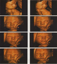 �����ơ�����ơ�B����JZ����ҽ�ý�Ƭ