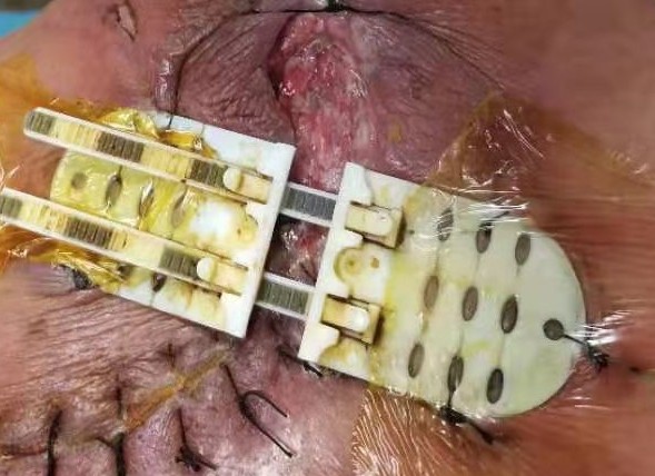 Ƥ�����űպ���