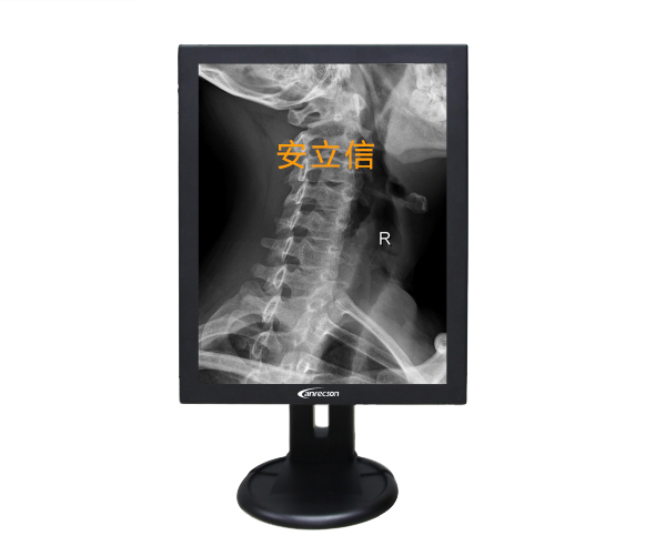 21.3��2M�ҽ�/19.6��2�׻ҽ�/20.1��2MP�ҽ����ҽ����Ƭ������ʾ��