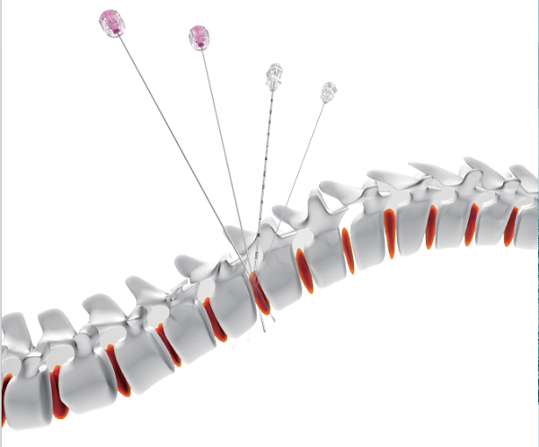 һ����ʹ��׵���̴�����