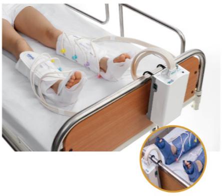 ��Ъ�����ѹ��˨ϵͳAngio Press 8ǻ������