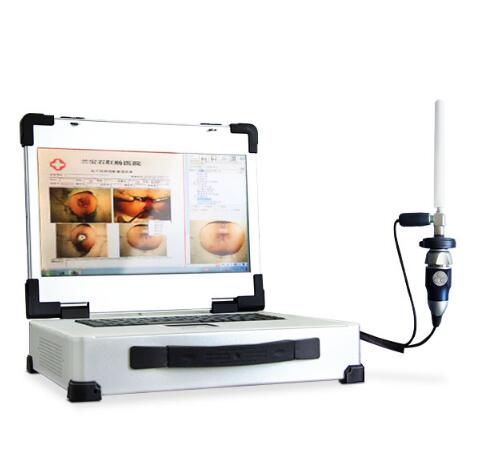 ���Ӹ�Ƶ�ۺ������ǣ�CCD��״�᳦����