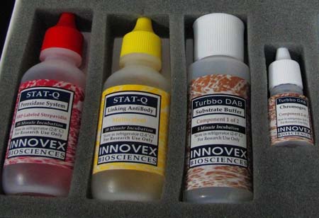 Innovex STAT-Q�Լ���