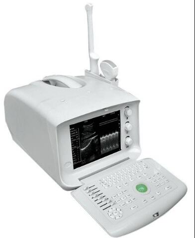 ��ЯʽB����