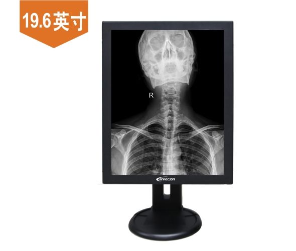 19.6Ӣ��/20.1��/21.3��/22��2M�ҽ�Ӱ����ʾ��