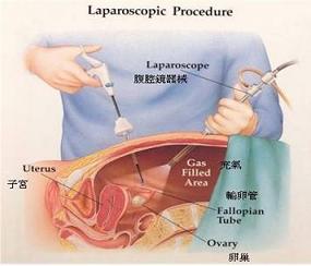 ��ǻ��ģ��ѵ����