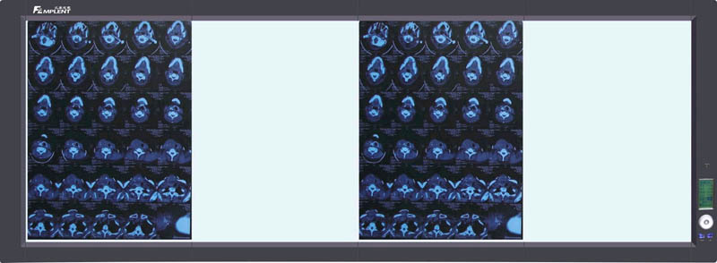 LED��Ƭ��