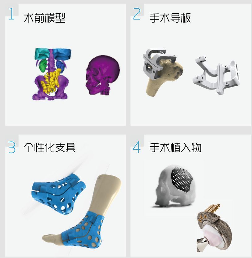 3D��ӡ��ǰģ�� ���Ի�֧�ߡ�����ֲ����