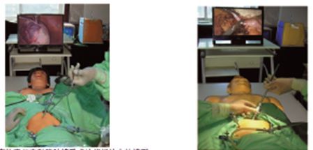 �߷��渹ǻ����������ѵ������ģ��