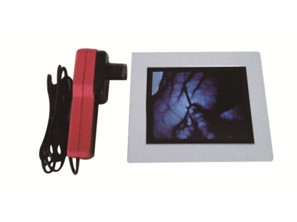 东发医疗厂家招商DF-700静脉显像仪血管显像仪 静脉定位仪