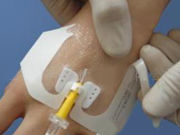 蝶形留置针专用敷贴（U型口敷料）