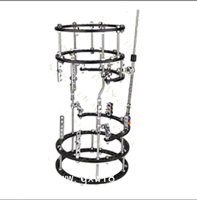 组合式骨固定器