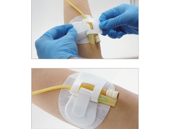 一次性使用无菌敷贴（导管固定贴）