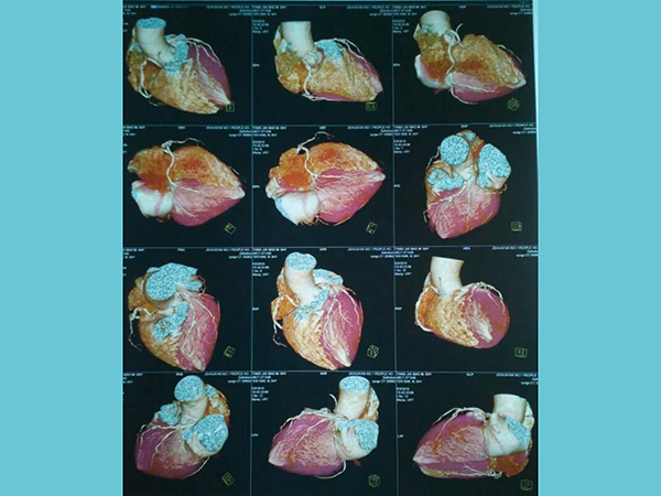 西施康牌医用干式胶片--彩色喷墨、激光胶片
